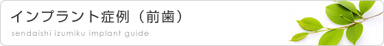 インプラント症例（前歯）