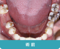 術前