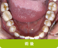 術後