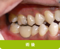 術後